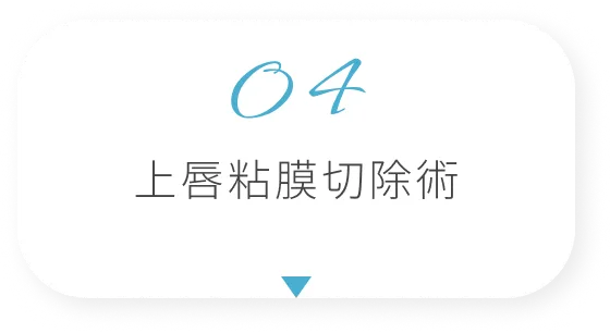 上唇粘膜切除術
