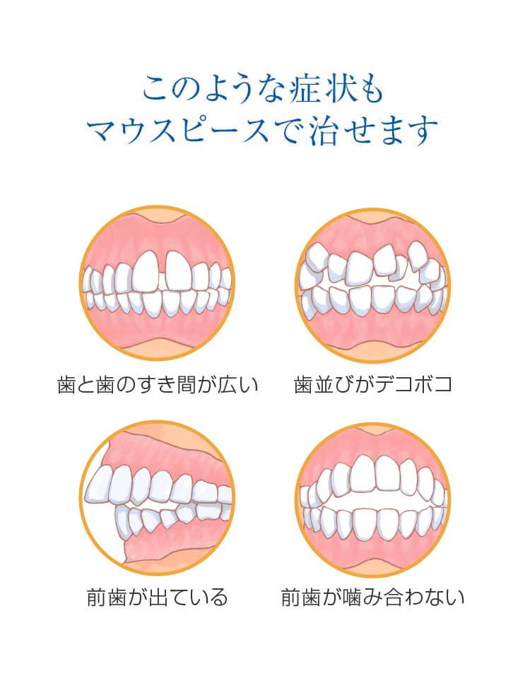 歯の模型を持っている女性